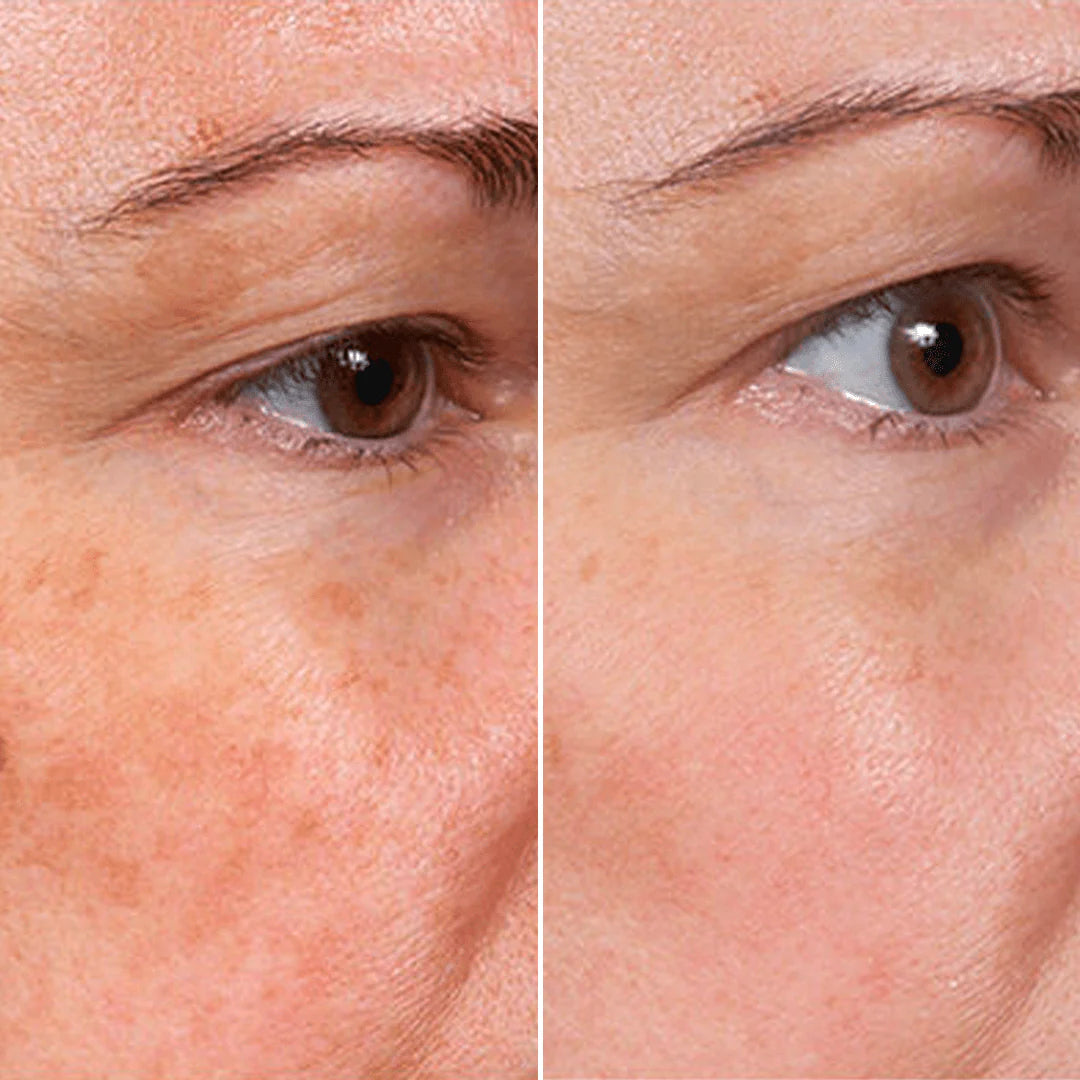 REJUVENATE FACE TREATMENT