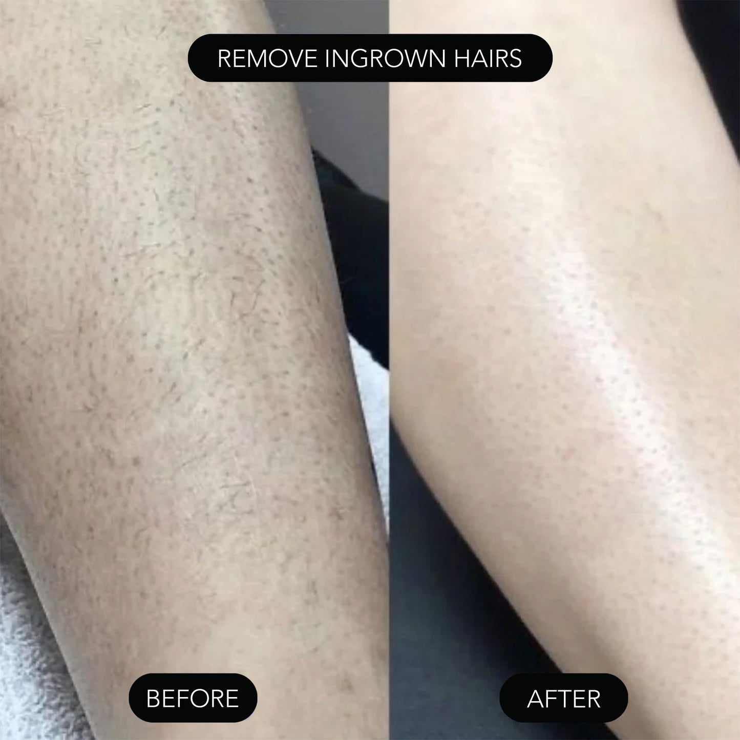 PAINLESS BODY HAIR REMOVAL CREAM