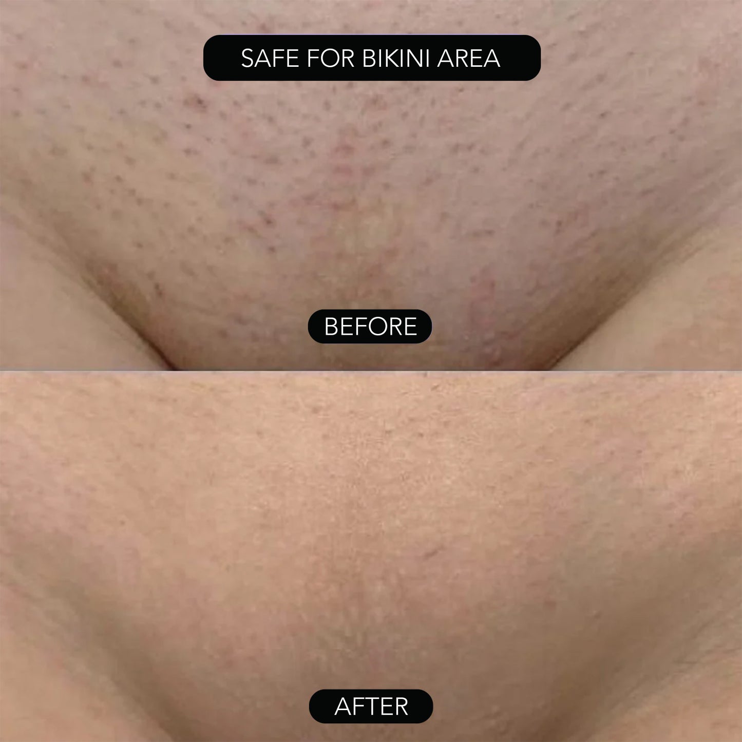 PAINLESS BODY HAIR REMOVAL CREAM