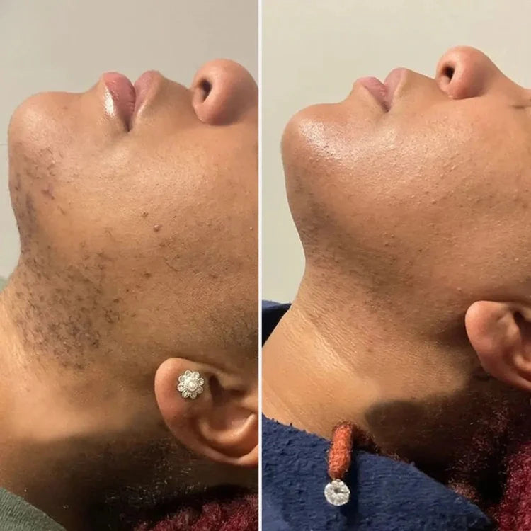 PAINLESS BODY HAIR REMOVAL CREAM