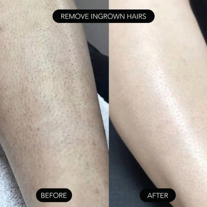 PAINLESS BODY HAIR REMOVAL CREAM