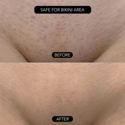 PAINLESS BODY HAIR REMOVAL CREAM